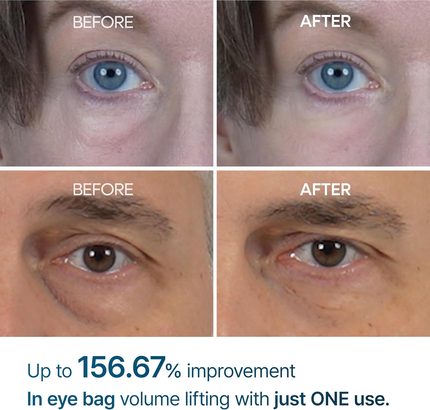 Dr.Melaxin Eyebag Cream