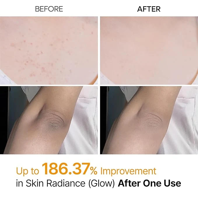 Dr. Melaxin Peel Shot Exfoliating Spray (200ml)